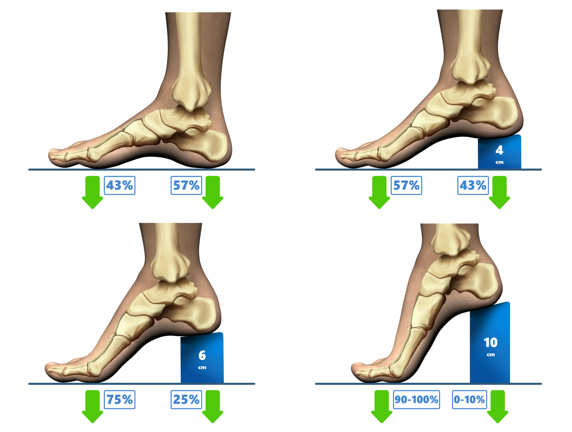 Ilustracja przedstawia obciążenie pierwszej kości śródstopia w butach na niskim i wysokim obcasie. Na pierwszym rysunku stopa umieszczona jest na płaskim podłożu. Oznaczono obciążenie śródstopia na poziomie 43% i pięty na poziomie 57%.  Na drugim rysunku stopa umieszczona jest na płaskim podłożu i 4 centymetrowym obcasie. Oznaczono obciążenie śródstopia na poziomie 57% i pięty na poziomie 43%.  Na trzecim rysunku stopa umieszczona jest na płaskim podłożu i 6 centymetrowym obcasie. Oznaczono obciążenie śródstopia na poziomie 75% i pięty na poziomie 25%.  Na czwartym rysunku stopa umieszczona jest na płaskim podłożu i 10 centymetrowym obcasie. Oznaczono obciążenie śródstopia na poziomie 90-100% i pięty na poziomie 0-10%. 