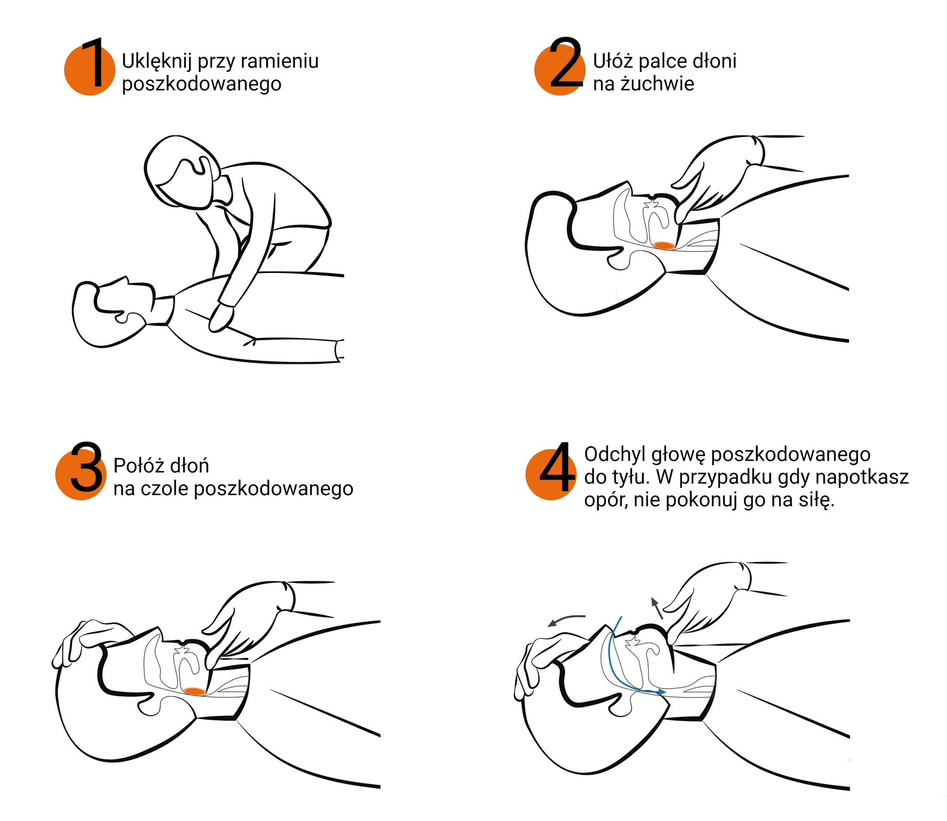 Na ilustracji instrukcja udrażniania dróg oddechowych. Numer jeden: uklęknij przy ramieniu poszkodowanego. Numer dwa: ułóż palce dłoni na żuchwie. Numer trzy: połóż dłoń na czole poszkodowanego. Numer cztery: odchyl głowę poszkodowanego do tyłu. W przypadku, gdy napotkasz opór, nie pokonuj go na siłę.