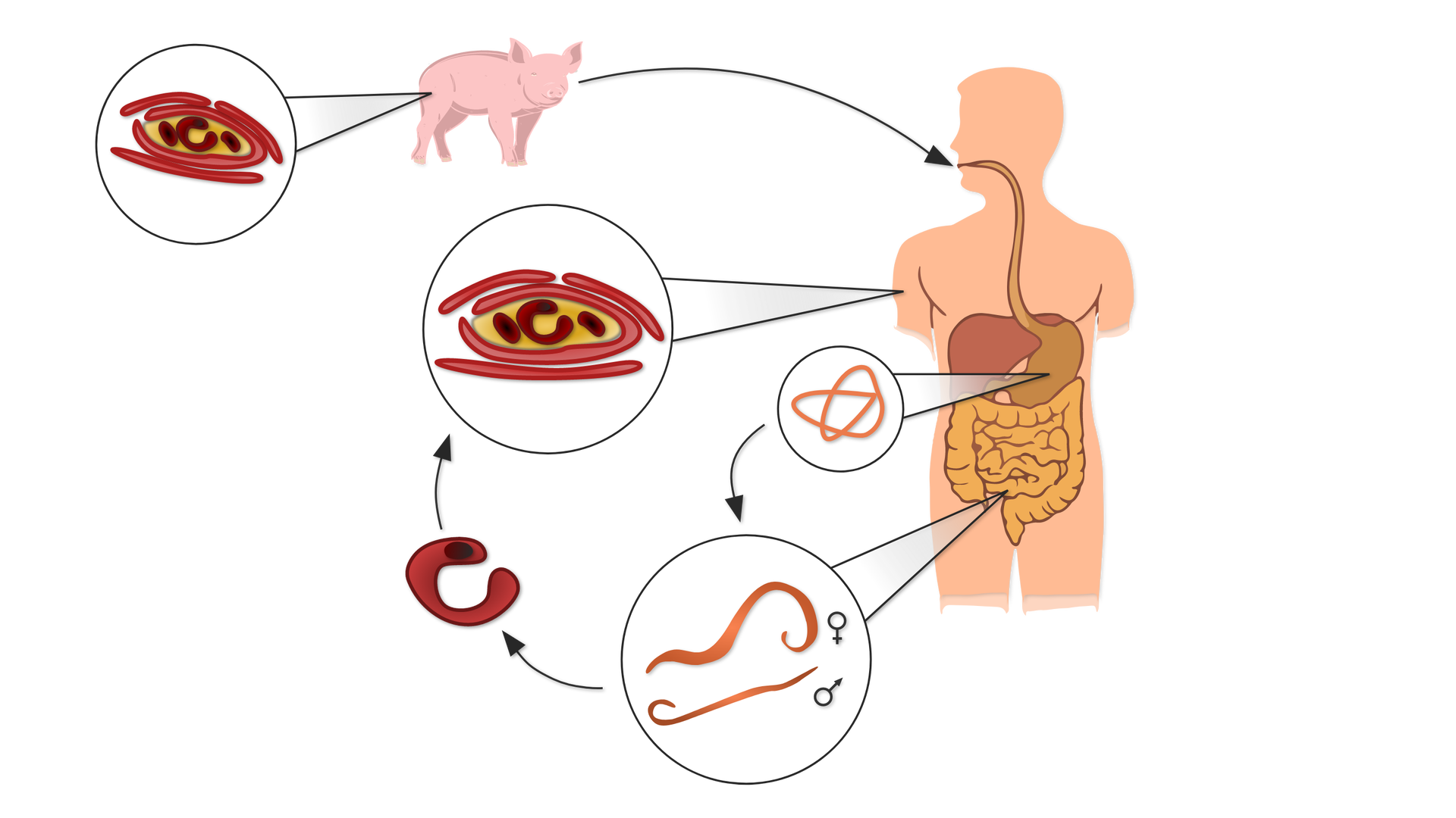 Na planszy widoczna jest ilustracja modelu człowieka z układem pokarmowym. Do jego ust skierowana jest strzałka, która wychodzi od różowej świni i czerwono‑żółtego, owalnego jaja nicienia. Z żołądka skierowana jest strzałka do różowego, pozawijanego nicienia, od niego do pociągłych, różowych przedstawicieli, męskiego i żeńskiego, nicieniów, dalej do zgiętego, krótkiego, czerwonego osobnika i następnie do owalnego jaja nicienia.