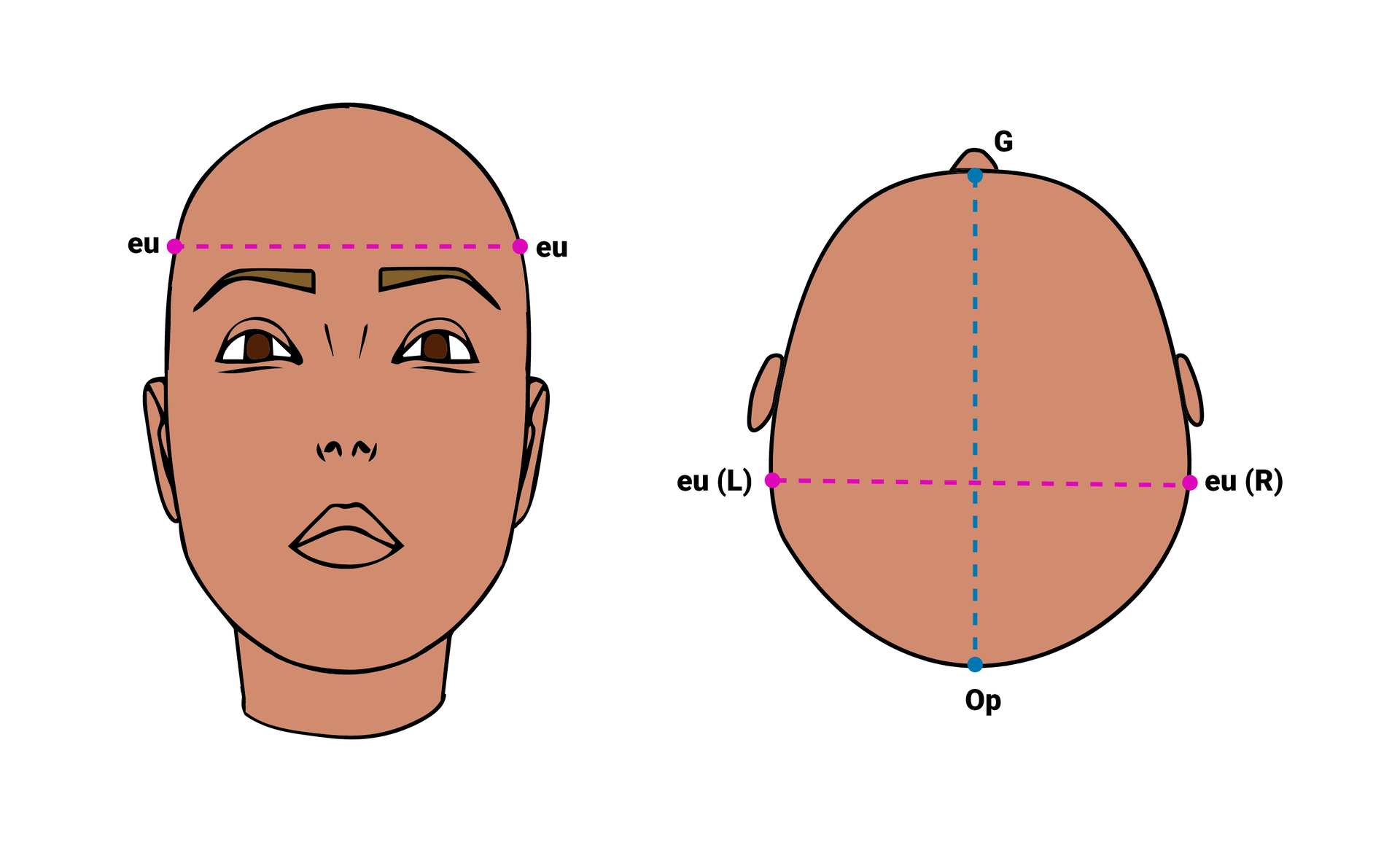 Grafika przedstawiająca położenie punktów euryon‑euryon. Punkty te znajdują się ponad uszami na wysokości skroni.
