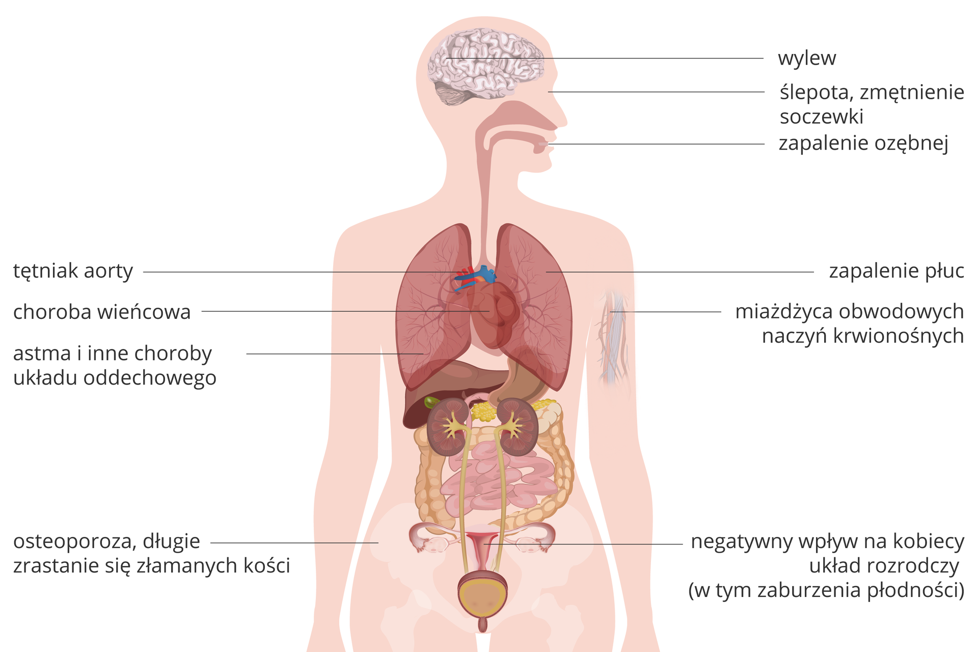 W galerii są ilustracje odnoszące się do skutków palenia papierosów. Ilustracja przedstawia sylwetkę człowieka z wrysowanymi narządami, głowa w prawo. Podpisy informują o przewlekłych chorobach narządów, związanych z paleniem papierosów. Od głowy: przy mózgu wylew, przy oku ślepota, zmętnienie soczewki, przy jamie ustnej zapalenie ozębnej. Przy tułowiu: zapalenie płuc, miażdżyca obwodowych naczyń krwionośnych, negatywny wpływ na układ rozrodczy (w tym zaburzenia płodności). Po lewej od góry: tętniak aorty, choroba wieńcowa, astma i inne choroby układu oddechowego, osteoporoza, długie zrastanie się złamanych kości.