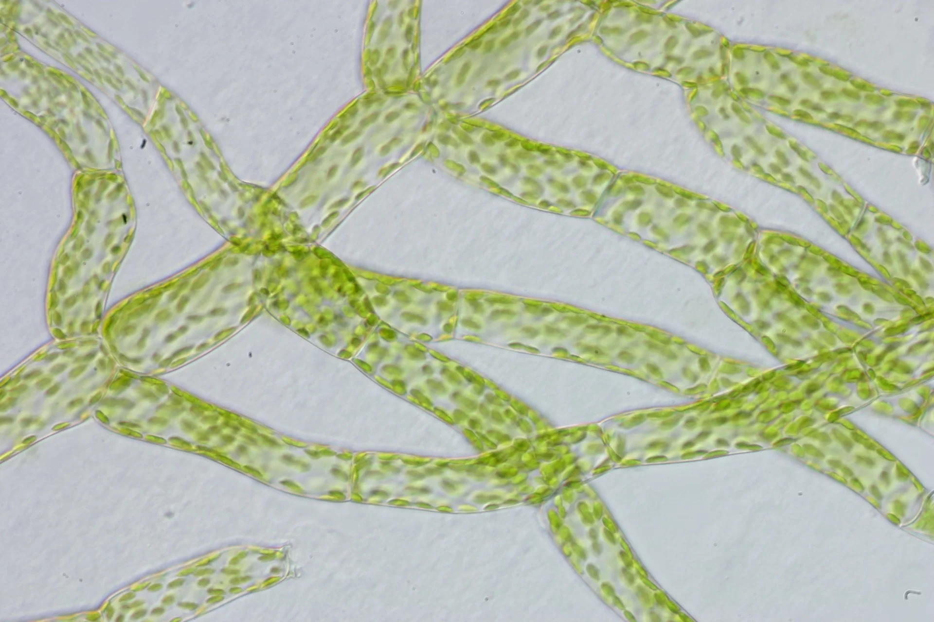 Zdjęcie przedstawia komórki splątka mchu w przybliżeniu mikroskopu. Są to rozgałęzione struktury z wyróżniającymi się zielonymi chloroplastami.  