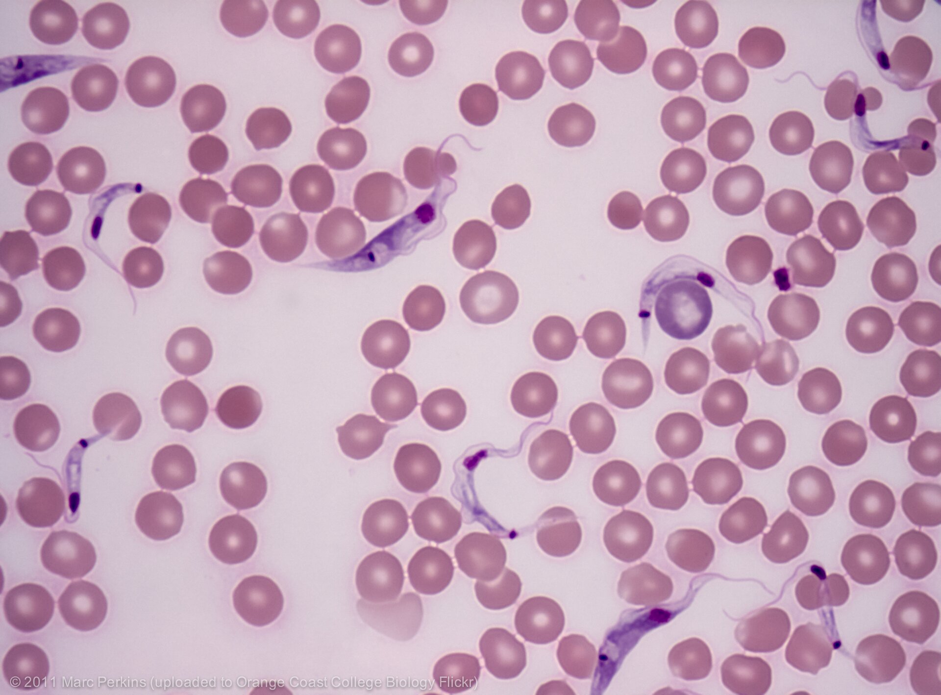 Zdjęcie spod mikroskopu świetlnego przedstawia świdrowce wśród widocznych od góry czerwonych krwinek. Świdrowce zabarwione są na fioletowo i są ok. 3 razy większe od jednej czerwonej krwinki. Ich ciało jest wydłużone i śrubowato skręcone. Mają charakterystyczną błonę falującą.