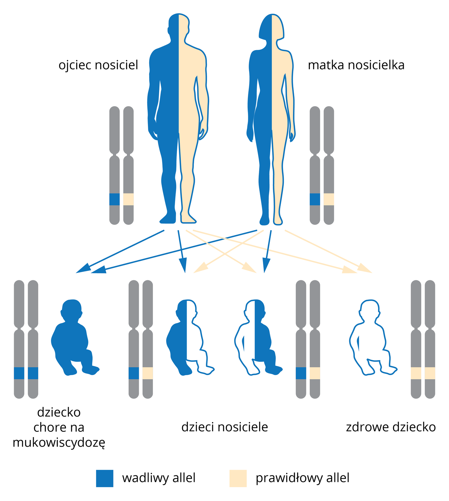 Ilustracja przestawia schematycznie dziedziczenie mukowiscydozy. U góry sylwetki mężczyzny i kobiety, w połowie niebieskie, w połowie różowe. Oboje są nosicielami allelu mukowiscydozy. Przy nich rysunek chromosomów z paskami w miejscu alleli. Kolor niebieski oznacza allel wadliwy, kolor różowy allel prawidłowy. Strzałki od rodziców prowadzą do sylwetek dzieci tej pary. Przy każdym chromosom z oznaczeniem alleli. Z lewej oba allele wadliwe, dziecko chore na mukowiscydozę, sylwetka niebieska. W środku dwie sylwetki dzieci w połowie niebieskie. To dzieci nosiciele wadliwego allelu. Z prawej dziecko zdrowe, sylwetka różowa.