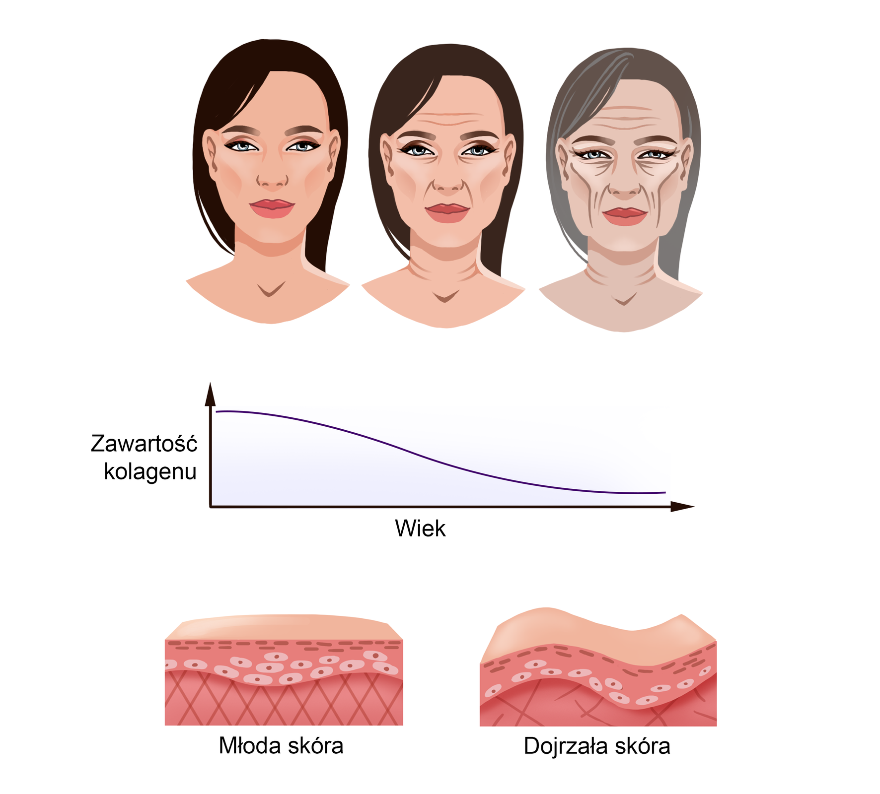 Grafika przedstawia zależność pomiędzy zawartością kolagenu w organizmie, a wiekiem oraz skutkiem zmniejszenia jego poziomu. Na samej górze grafiki znajdują się rysunki przedstawiające twarze trzech kobiet. Pierwsza z nich jest młoda, jej twarz jest gładka a włosy ciemne. Druga kobieta ma nieco jaśniejsze włosy, a na jej czole i w okolicach oczu widoczne są drobne zmarszczki. Trzecia kobieta ma wyraźnie siwiejące włosy i zmarszczki na całej twarzy.  Pod wizerunkami kobiet znajduje się wykres, pokazujący zależność pomiędzy zawartością kolagenu i wiekiem. Wraz z wiekiem ilość kolagenu zmniejsza się.  Ostatnia część grafiki prezentuje porównanie skóry młodej i dojrzałej. Skóra młoda jest gładka, natomiast skóra dojrzała jest wyraźnie zmarszczona. 