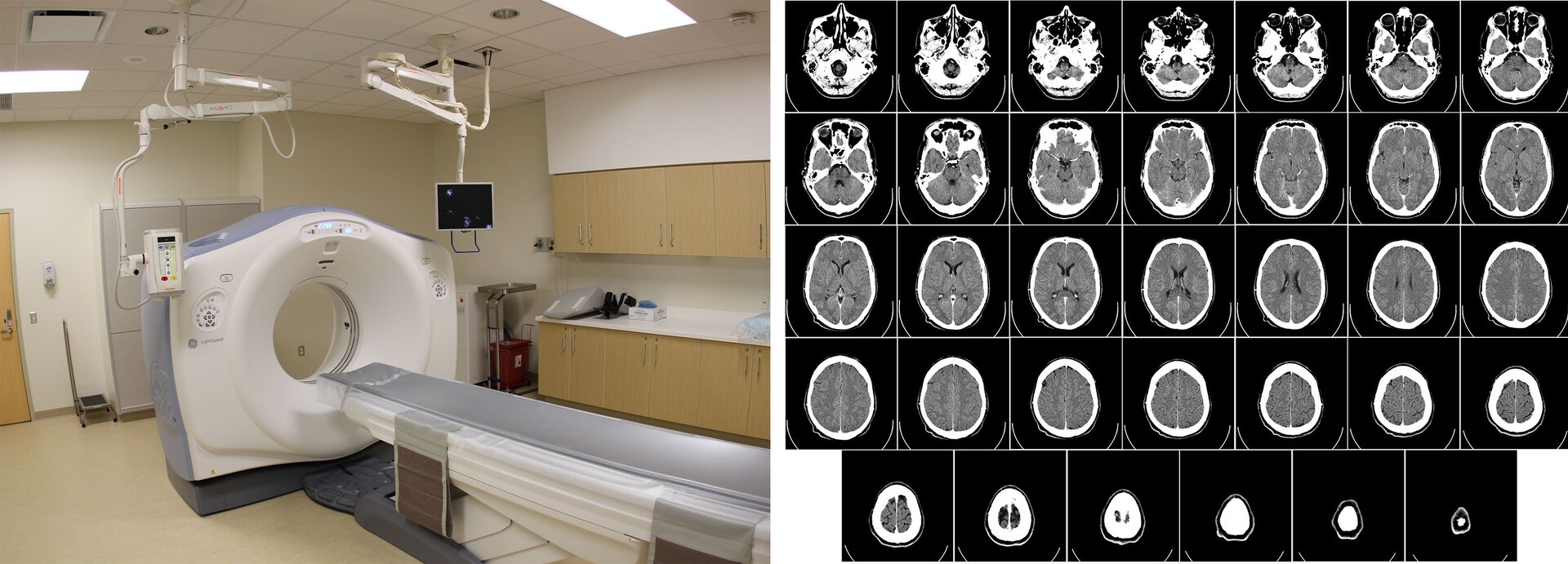 Rys. 2a. Ilustracja przedstawia zdjęcie tomografu komputerowego. Jest to szeroki pierścień, w który może wsuwać się leżanka dla pacjenta. Rys. 2b. Ilustracja składa się z wielu zdjęć z tomografu, pokazujących wnętrze ludzkiego ciała.
