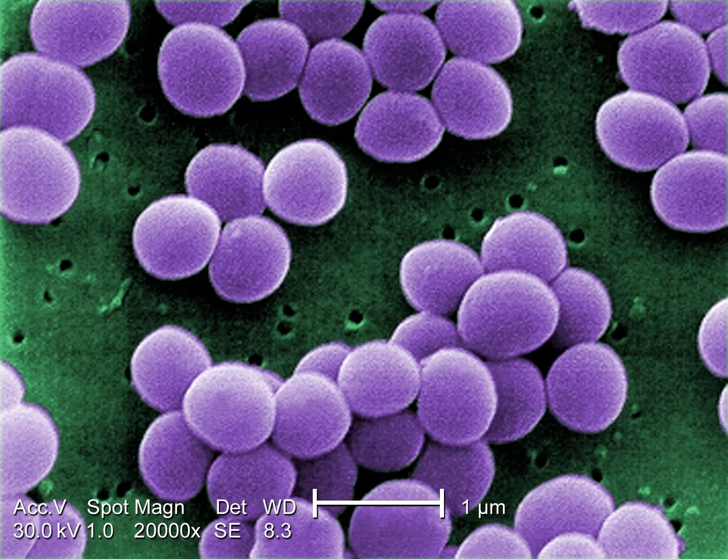 Mikroskopowe zdjęcie bakterii gronkowca złocistego Staphylococcus aureus. Kształt bakterii przypomina grona.