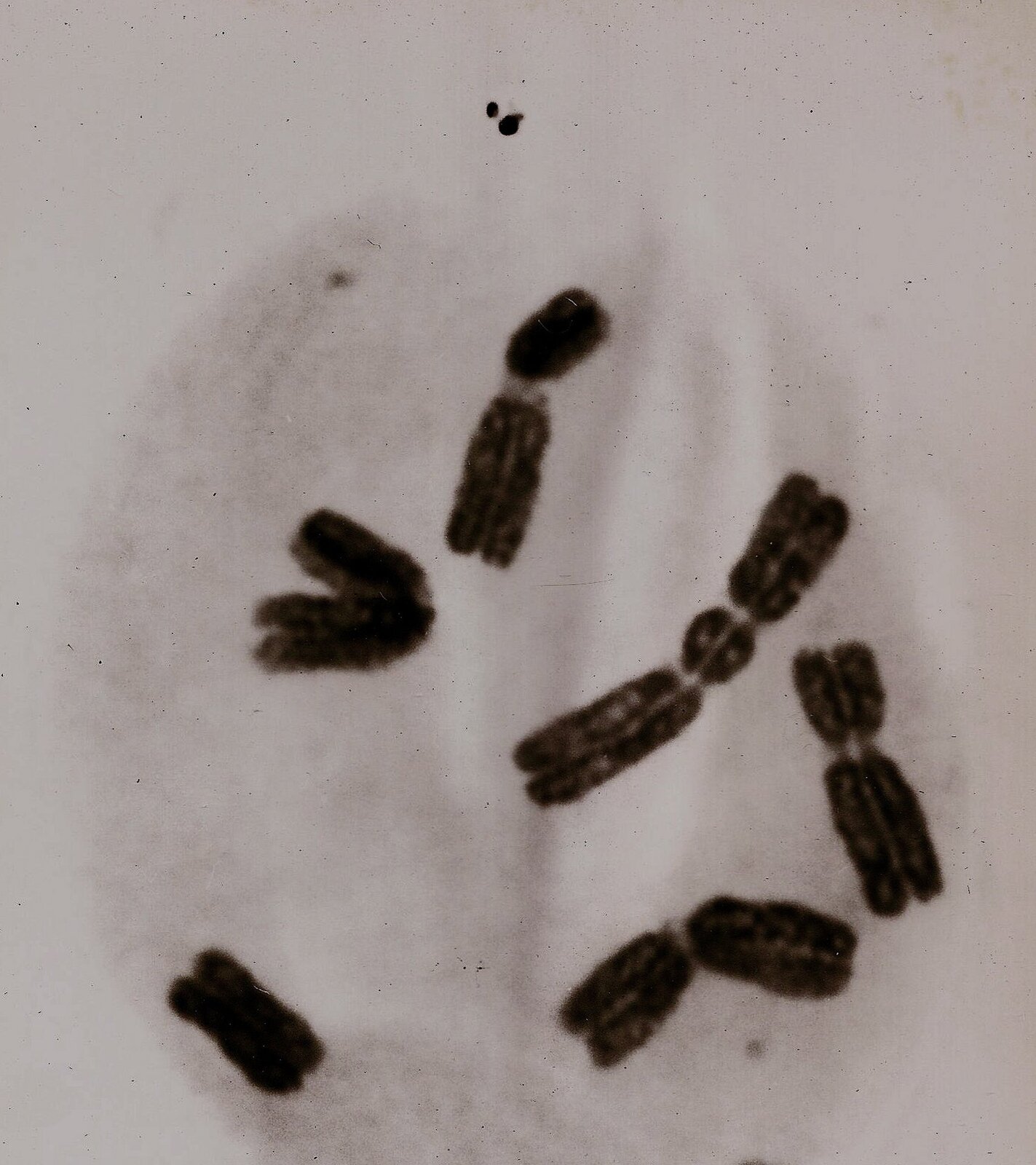 Rys. 8a. Zdjęcie przedstawia obraz mikroskopowy chromosomów człowieka, który uległ napromienieniu. Na szarym tle widać sześć układów chromosomów w postaci podłużnych czarnych brył różnie ułożonych.