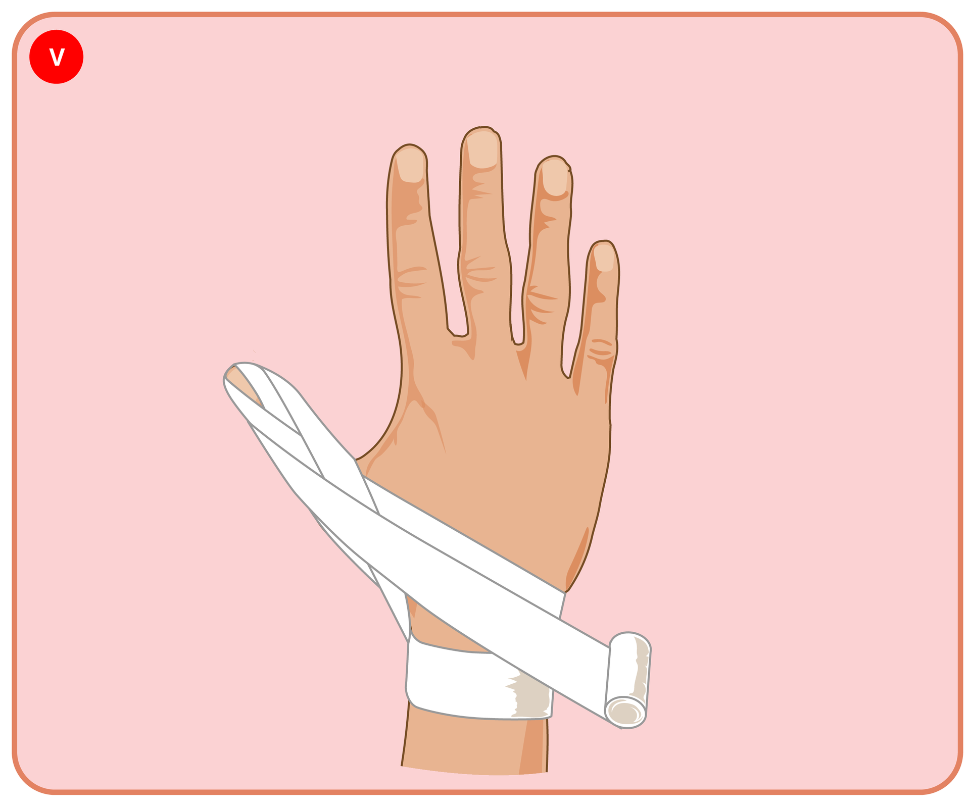 Fotografia przedstawia ponowne kłosowanie bandażem na kciuku