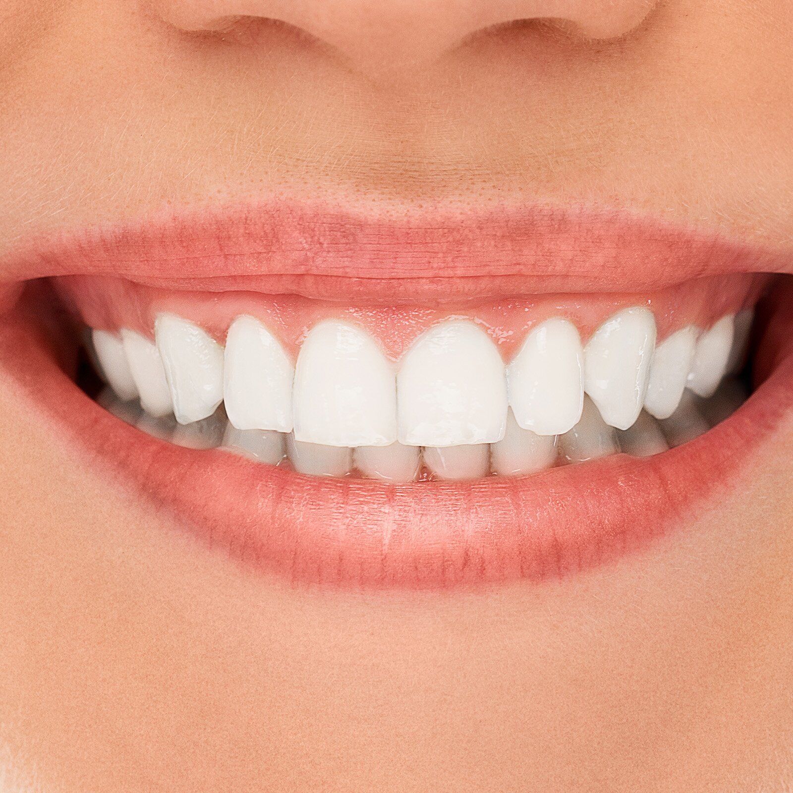 Zdjęcie przedstawia uśmiech, ukazujący śnieżnobiałe zęby.