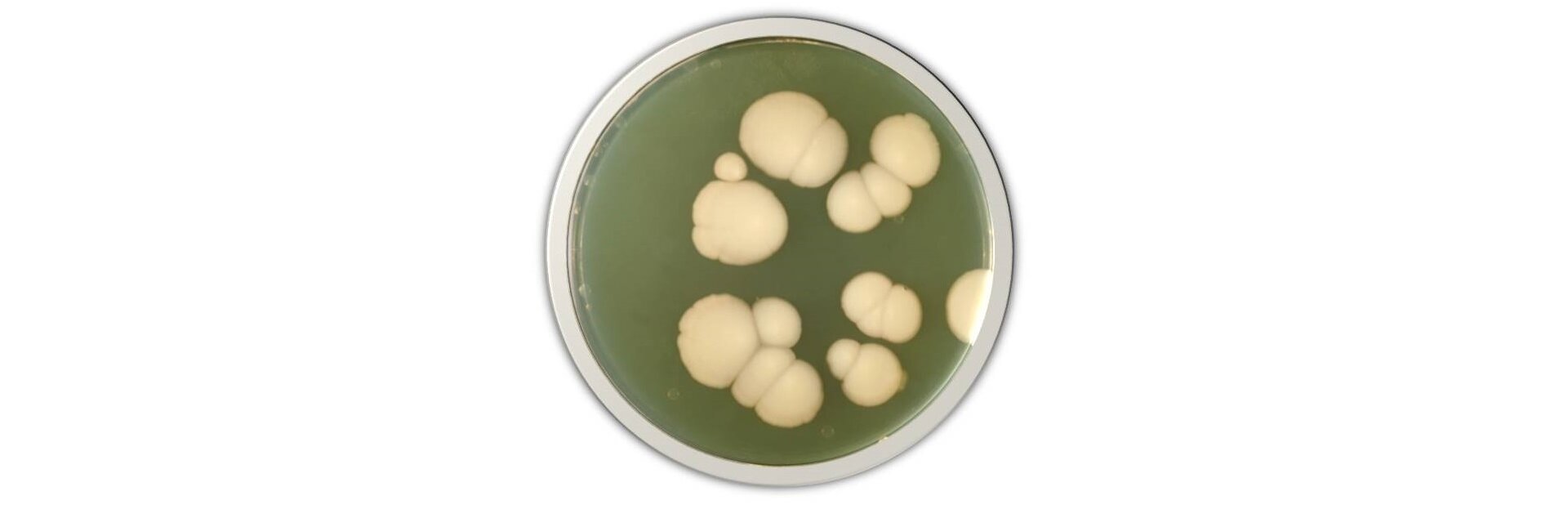 Na zdjęciu na szalce Petriego znajduje się jasnożółta pożywka. Na jej powierzchni są drobnoustroje - skupisko wielu, drobnych komórek.  Są jaśniejsze od pożywki.  