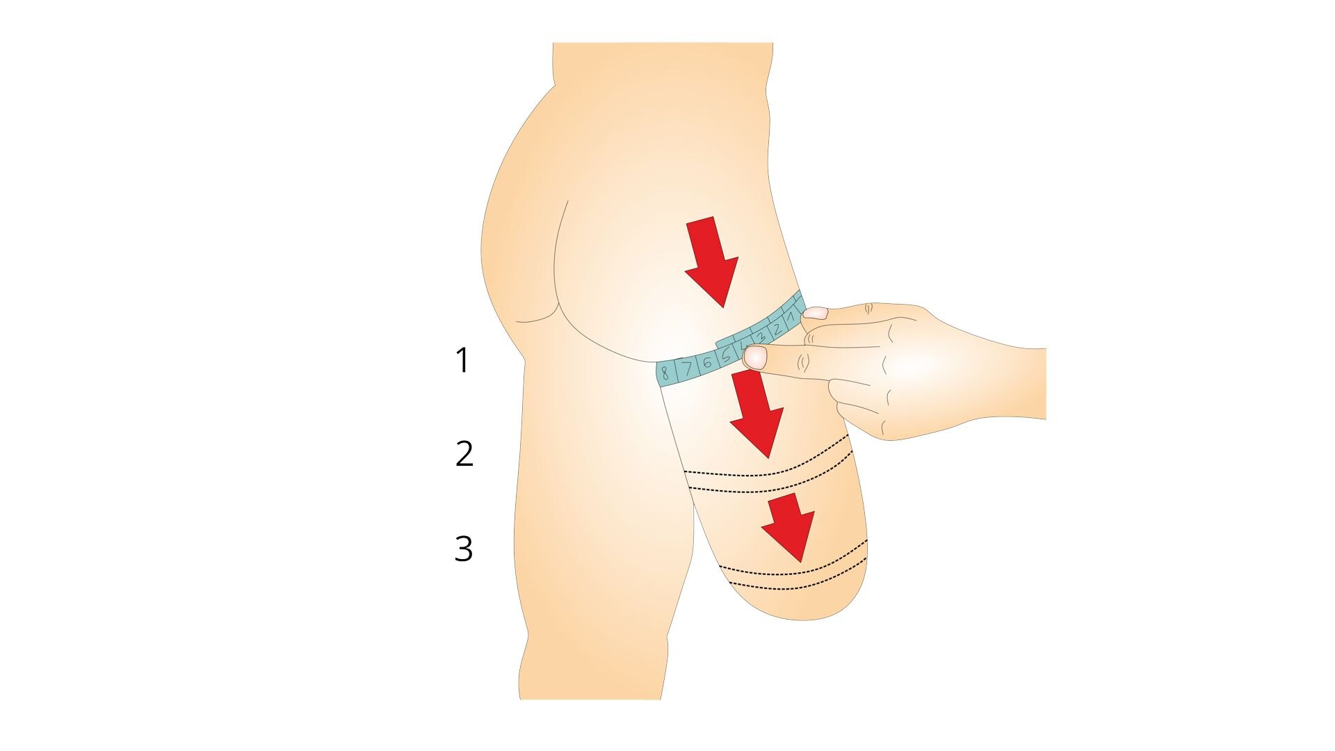 Rycina przedstawia budowę człowieka od tyłu, od pasa do stawu kolanowego. Prawa kończyna została amputowana na wysokości stawu kolanowego. Na grafice znajduje się również dłoń osoby dokonującej pomiarów kikuta. Strzałki pokazują kolejność wykonywania tej czynności. Cyfrą 1 oznaczone jest miejsce pod pośladkiem. Cyfrą 2 oznaczony jest środek kikuta. Cyfrą 3 oznaczony jest najszerszy obwód kikuta, nad stawem kolanowym.