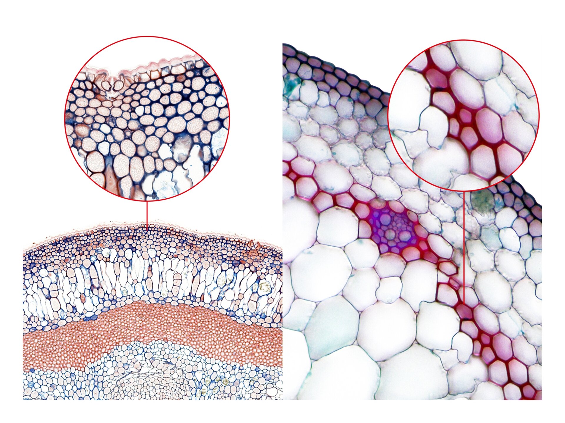 Ilustracja przedstawia dwa zdjęcia mikroskopowe -po lewej przekrój przez łodygę z komórkami zwarcicy pod tkanką okrywającą oraz przybliżenie na te komórki- widoczne wybarwione na granatowo zgrubienia w narożnikach komórek. Po prawej fotografia mikroskopowa komórek twardzicy w liściu draceny. Są one wybarwione na czerwono. U góry w przybliżeniu ukazano fragment z komórkami twardzicy o zgrubiałych ścianach.