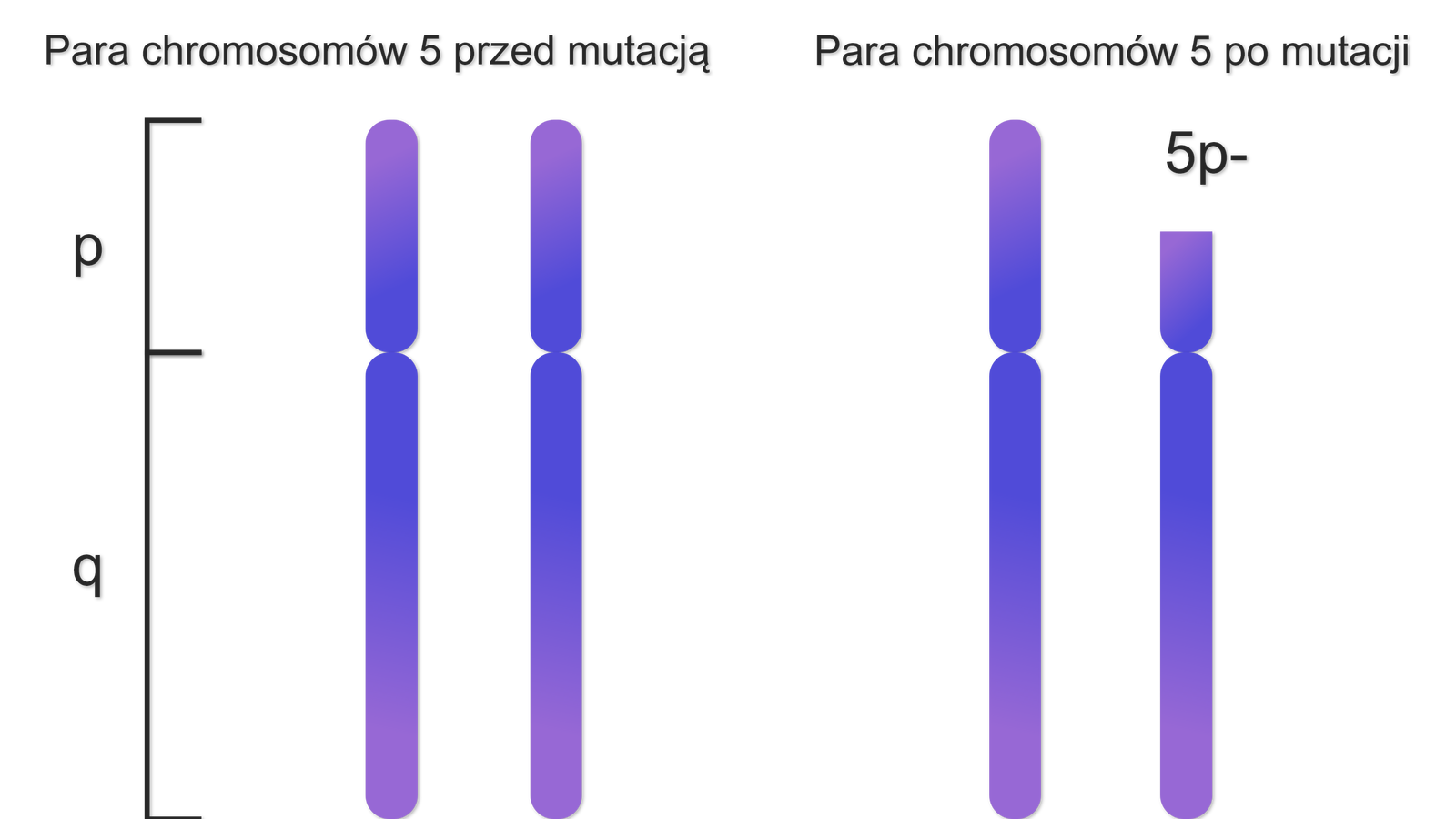Grafika przedstawia dwa zestawienia par chromosomów. Chromosomy składają się z części krótszej i dłuższej. Obok nich znajduje się klamra z oznaczeniami. P dla części krótszej chromosomu, q dla części dłuższej chromosomu. Rysunek po lewej stronie prezentuje parę chromosomów 5 przed mutacją. Każdy z pary chromosomów jest złożony z elementu p i elementu q. Rysunek po prawej stronie prezentuje parę chromosomów 5 po mutacji. Każdy z pary chromosomów jest złożony z elementu p i elementu q, przy czym chromosom drugi ma skrócony element p o wartości 5p-.