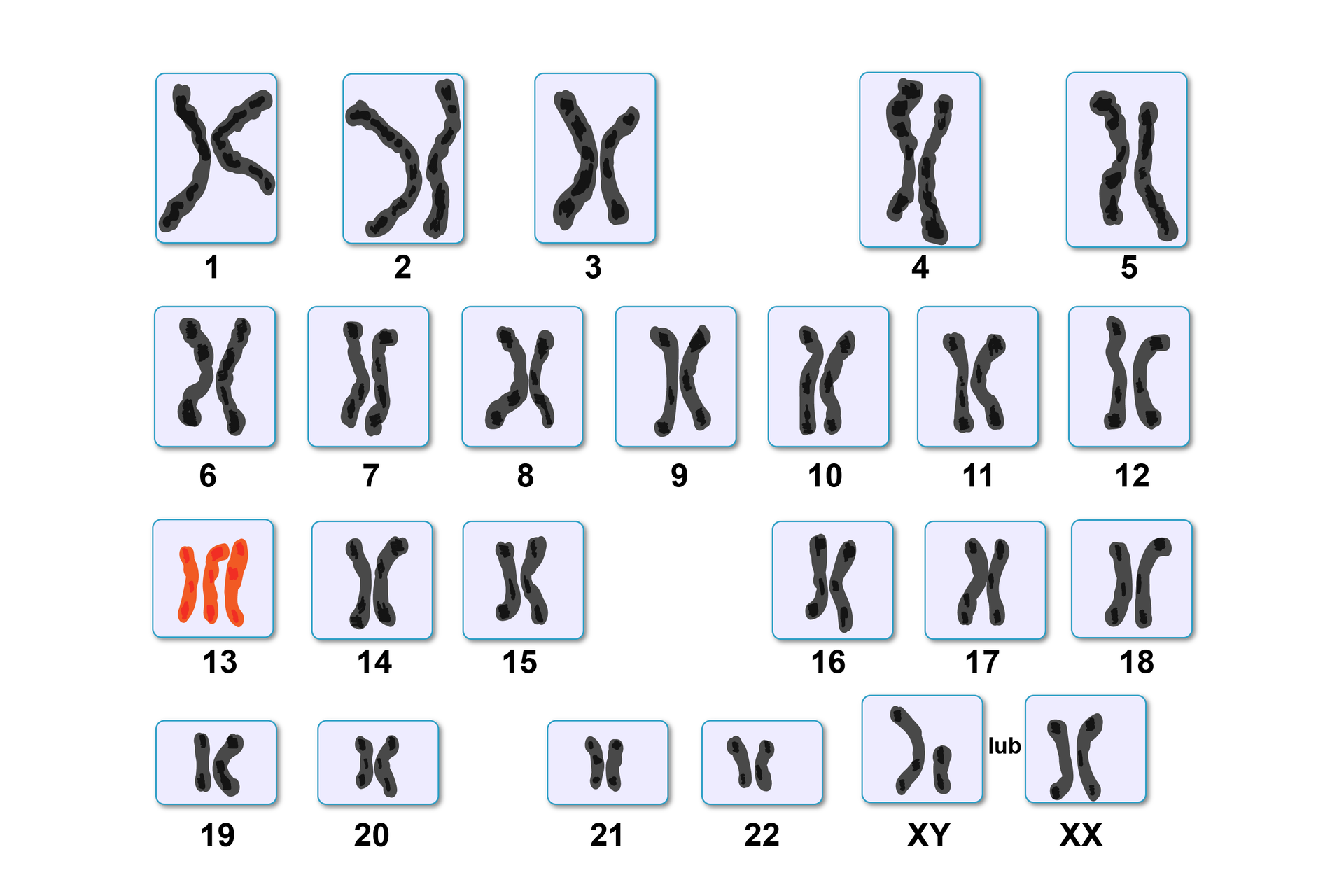 Ilustracja przedstawia kariotyp osoby z zespołem Pataua. Zawiera 22 pary chromosomów. Ostatnia para to chromosom XY lub XX. Pod numerem 13 są trzy chromosomy, zaznaczono je kolorem czerwonym.   