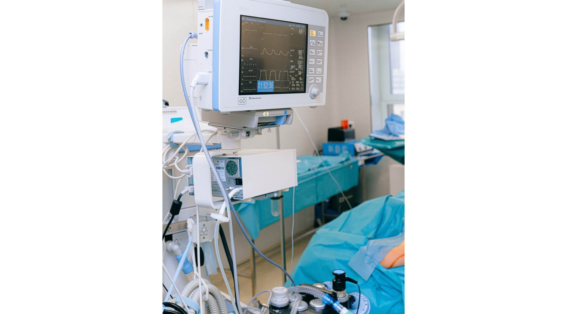 Pokój szpitalny z aparaturą medyczną podtrzymującą życie, połączoną licznymi przewodami elektrycznymi.