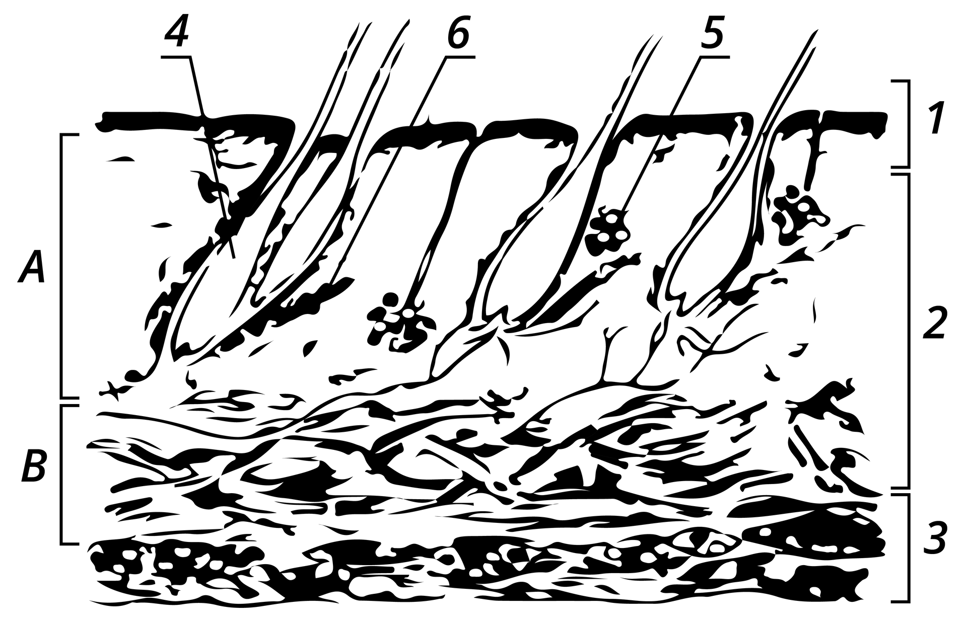 Na zdjęciu widoczny schemat w kształcie prostokąta. Z lewej strony podzielony na części A (górna) i B (dolna), z prawej na trzy części ponumerowane kolejno od góry. Kolejne numery wyznaczają poziomy głębokości skóry. W górnej części widoczne włosy z cebulkami, od nich odchodzą trzy kolejne numery (cztery, pięć, sześć) wskazujące poszczególne elementy skóry.