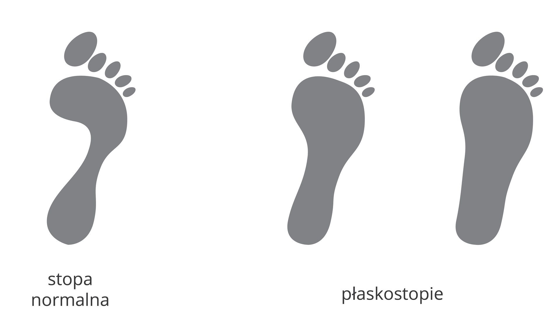W galerii znajdują się dwie plansze, poświęcone przyczynom i skutkom wad stóp. Ilustracja przedstawia 3 czarne odciski stóp (prawa noga). Z lewej stopa normalna, z prawej dwie stopy o różnym stopniu płaskostopia. Płaskostopie polega na tym, że zbyt duża część powierzchni stopy styka się z podłożem. Stopa nie jest odpowiednio wysklepiona.