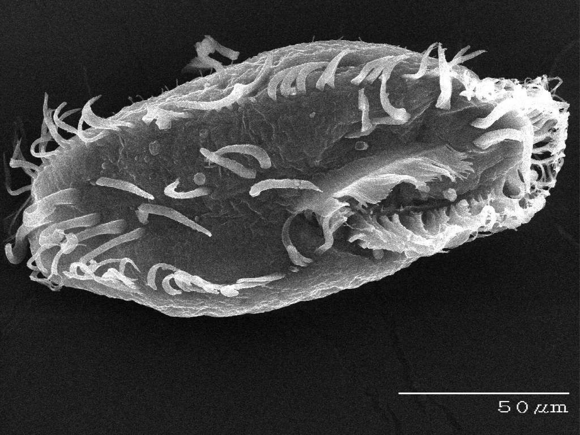 Zdjęcie mikroskopowe przedstawia protista o podłużnym kształcie. Posiada on liczne, drobne rzęski. 