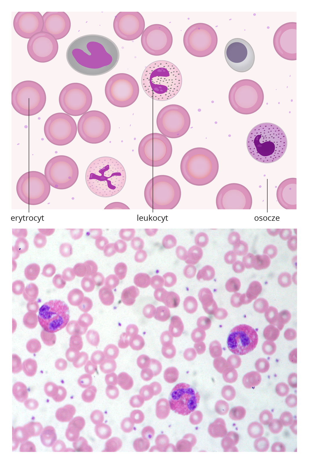 Dwie ilustracje. U góry schematyczny rysunek składników krwi. W jasnym prostokącie kilkanaście okrągłych, różowych komórek z jaśniejszym środkiem, symbolizujących erytrocyty. Okrągłe komórki nakrapiane w środku z rozgałęzionym, fioletowym jądrem to leukocyty. Jasne, kropkowane tło oznaczono jako osocze.Poniżej znajduje się obraz mikroskopowy krwi z licznymi małymi erytrocytami i trzema większymi, ciemniejszymi leukocytami.