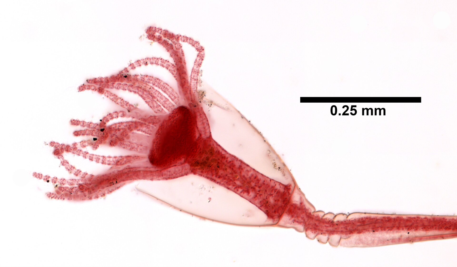 Zdjęcie B przedstawia jedną z form obelii. Zwierzę ma kształt wydłużonego worka. Na górnej części ciała znajdują się liczne ramiona. Po prawej stronie zdjęcia widać linię, która symbolizuje dwadzieścia pięć setnych milimetra. Obelia ma około pięćdziesięciu setnych milimetra.
