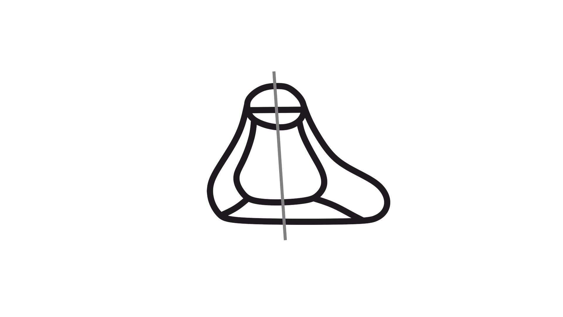 Grafika przedstawia obrys kopyta obuwniczego widziany z tyłu, z zaznaczoną osią pionową i wysuniętą stroną zewnętrzną.