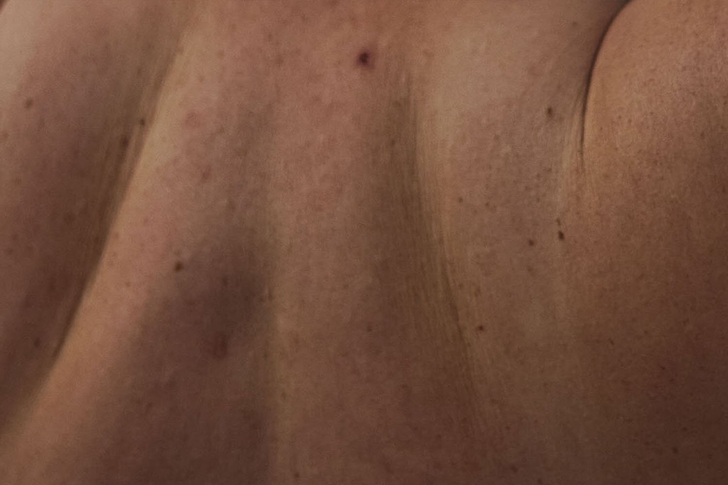 Zdjęcie przedstawia zbliżenie ludzkiej skóry z niedoskonałościami, takimi jak przebarwienia czy pieprzyki.