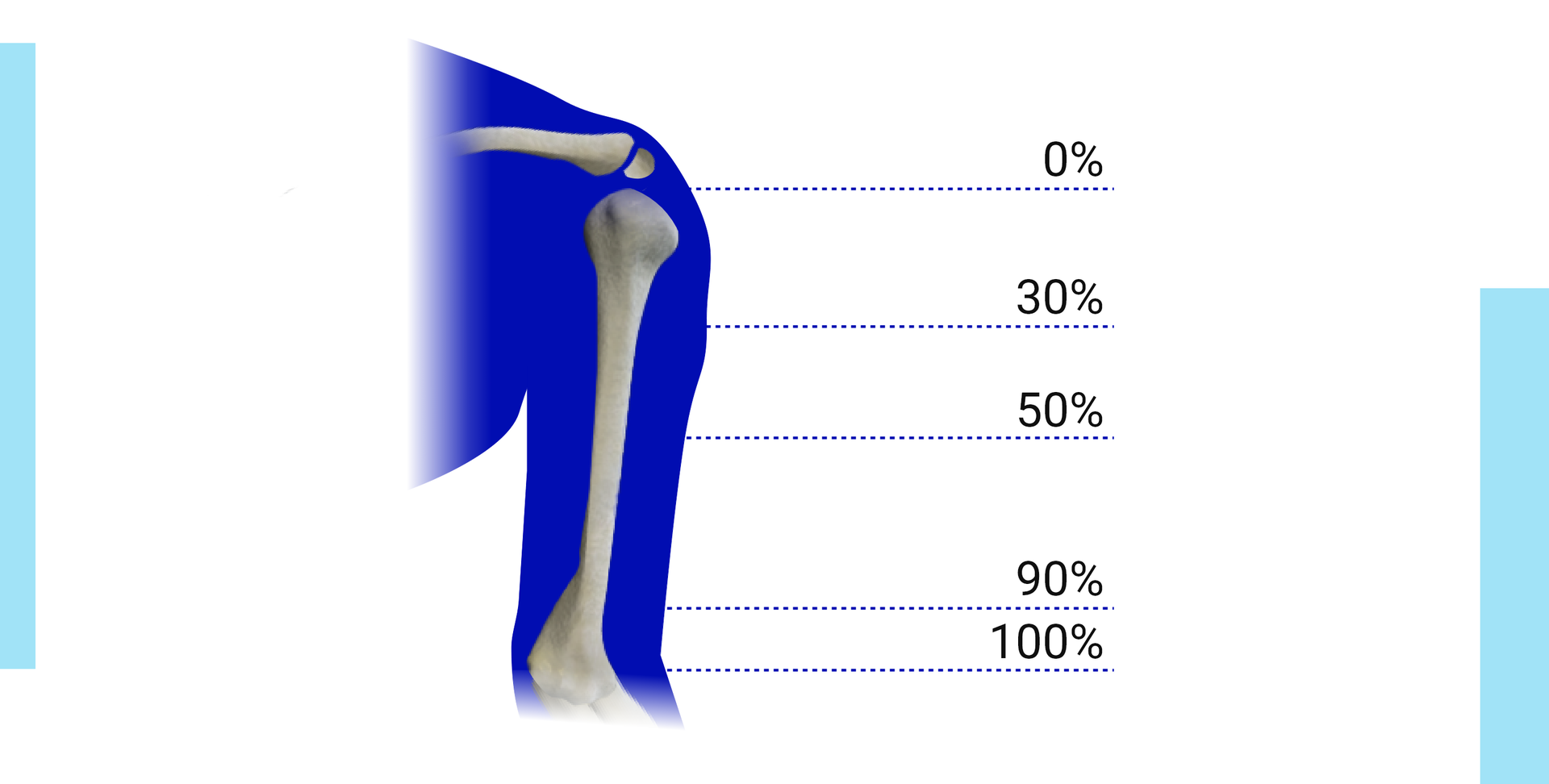 Grafika przedstawia schemat ramienia człowieka. Na rycinie zaznaczono elementy szkieletu obręczy barkowej i kończyny górnej oraz podano procentowe wartości długości kikutów ramienia.