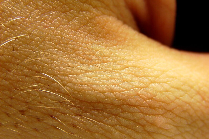 Zdjęcie przedstawia z bliska skórę człowieka. Z lewej widać kilka jasnych włosów.