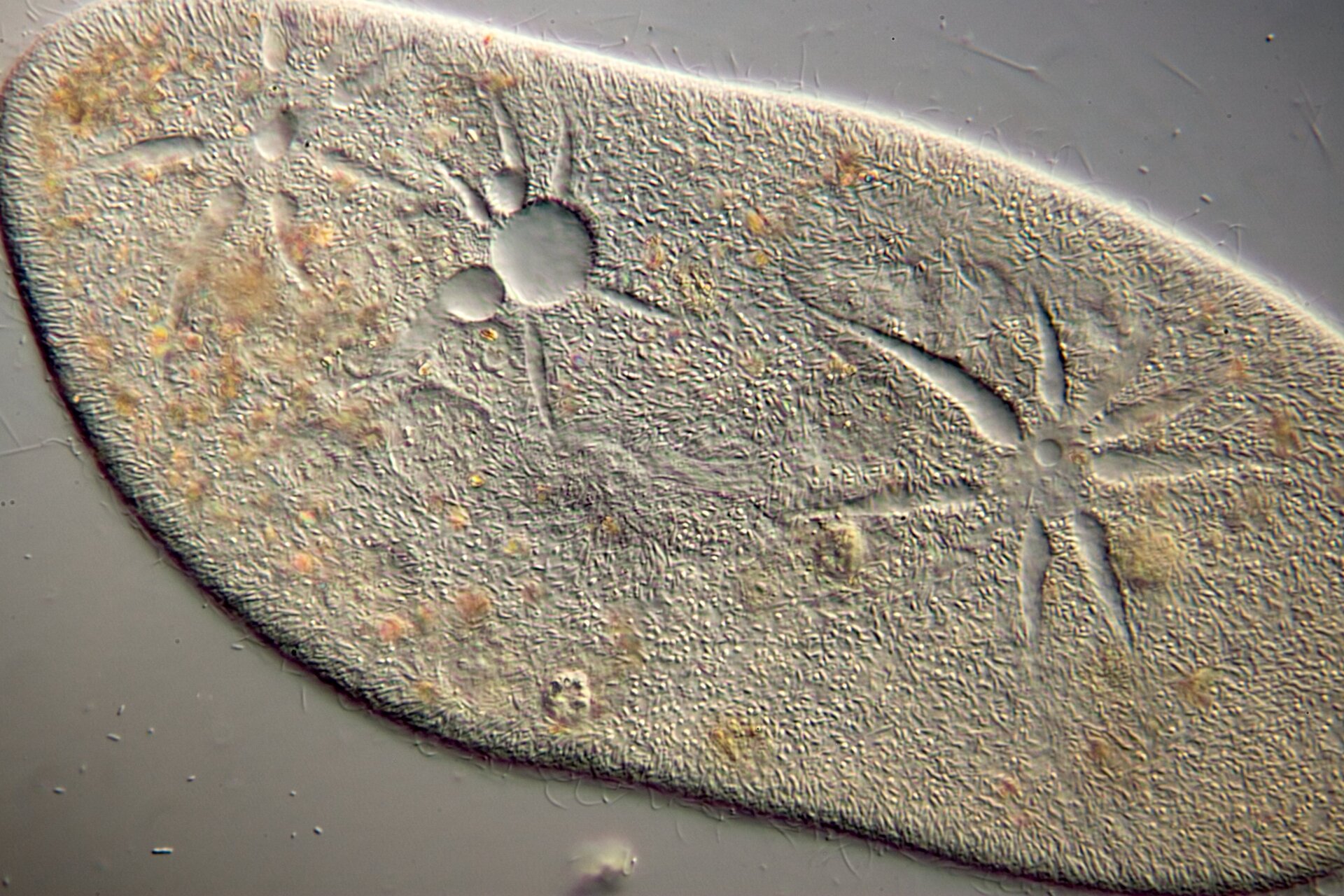 Fotografia przedstawia owalną, szaro‑brązową komórkę pantofelka. Widoczne są w niej wodniczki tętniące w kształcie "gwiazd" oraz mniejsze, okrągłe wodniczki pokarmowe.