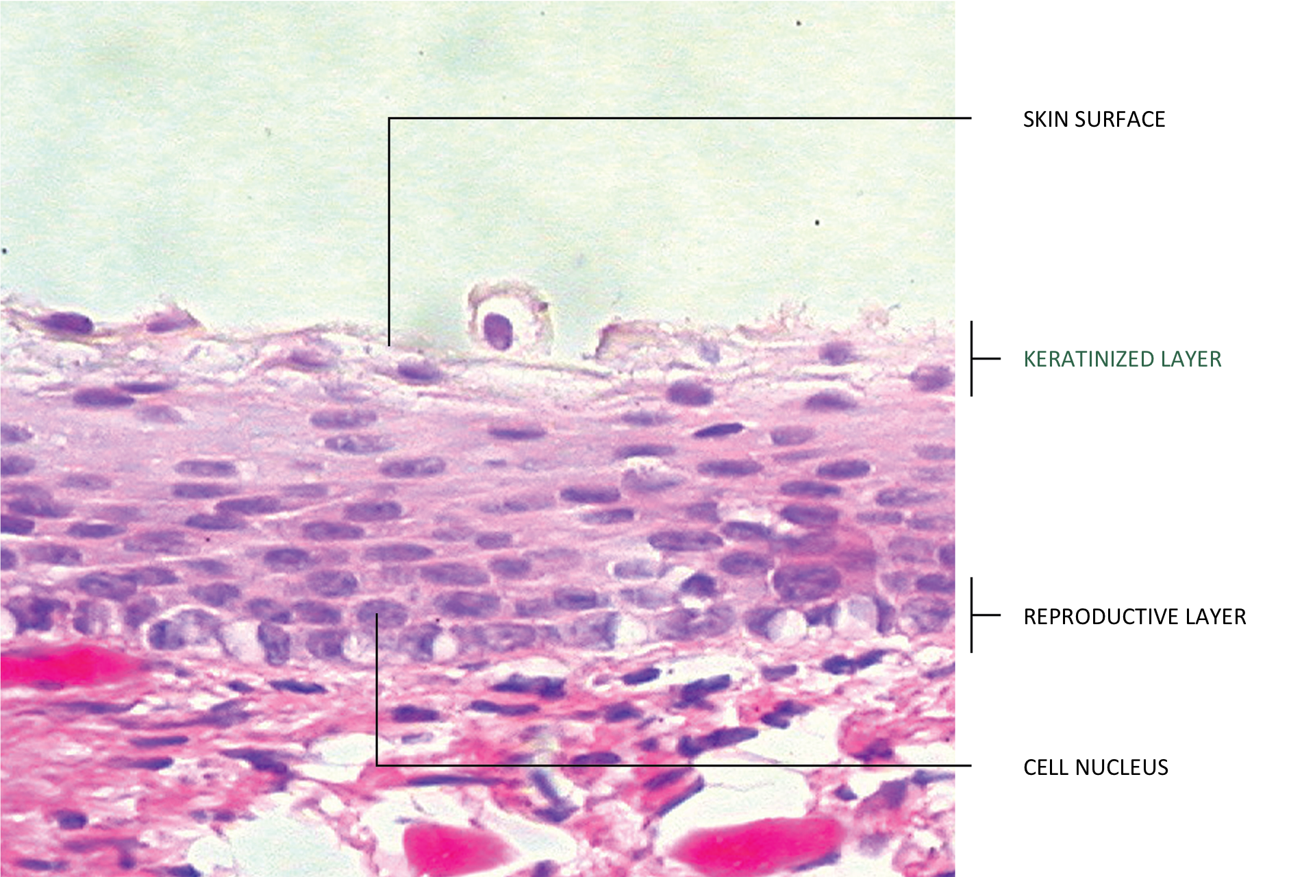 lustracja przedstawia błękitno – fioletowy obraz mikroskopowy nabłonka wielowarstwowego skóry z opisami. Od góry: powierzchnia skóry (skin surface), warstwa zrogowaciała (keratnized layer), warstwa rozrodcza (reproductive layer), jądro komórkowe (cell nucleus). Górna warstwa skóry ma komórki luźno ułożone, odrywające się. Pod nimi komórki nabłonka płasko ułożone, nie każda ma jądro. Warstwa rozrodcza zawiera komórki żywe, z dużymi jądrami komórkowymi. Poniżej naskórka jest wyraźnie granulowana, różowoczerwona warstwa skóry właściwej. 