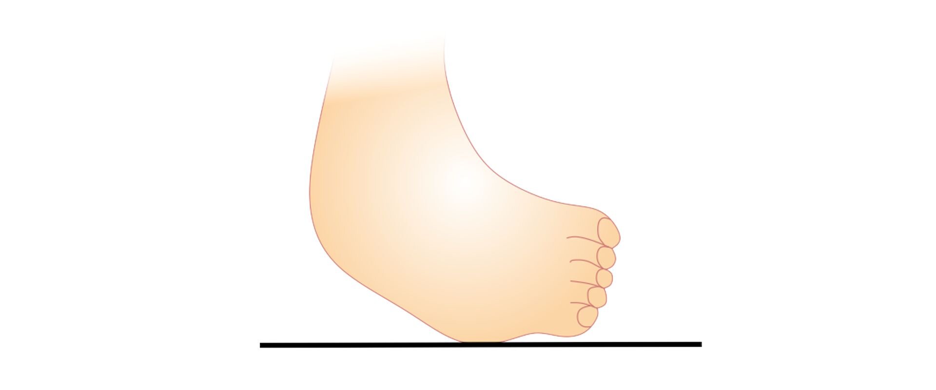 Grafika przedstawia stopę, której zewnętrzna strona skierowana jest do podłoża, a wewnętrzna jest uniesiona.