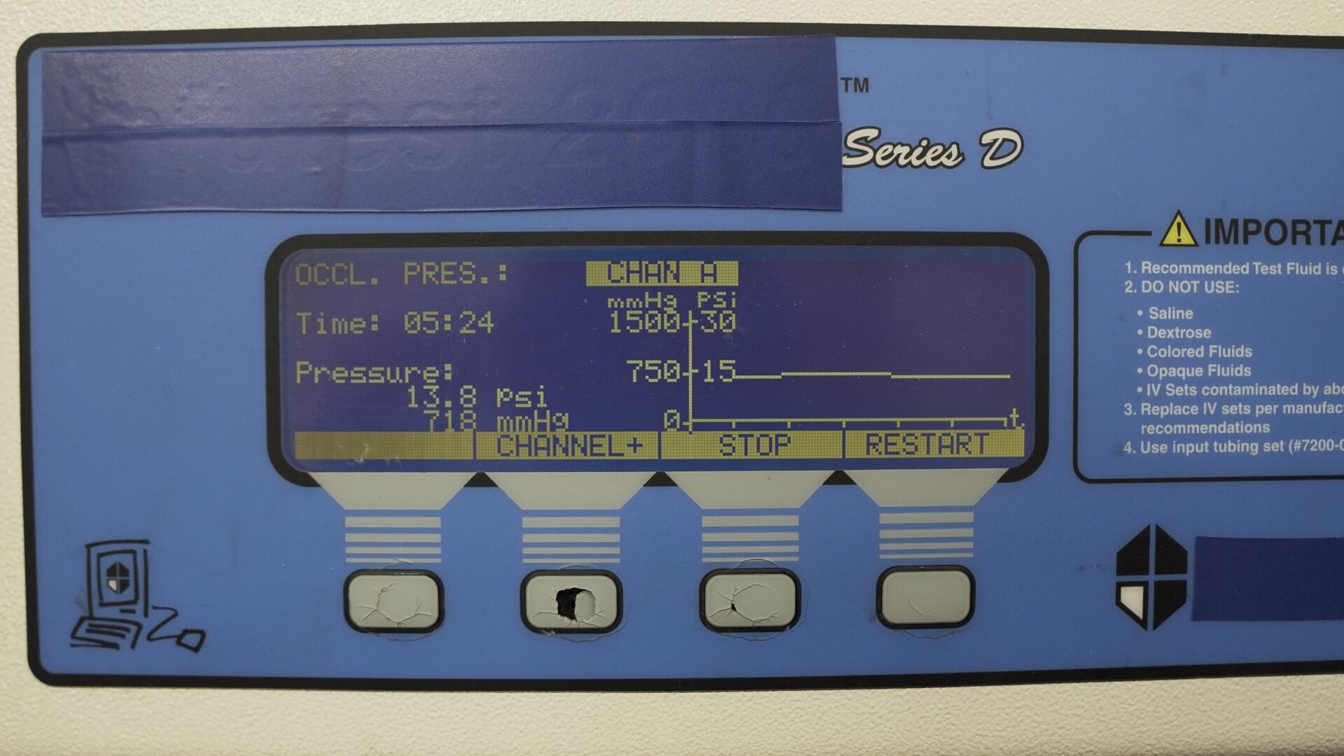 Na zdjęciu pokazane jest zbliżenie na ekran urządzenia testującego pompę infuzyjną. Wyniki przedstawione są w sposób tabelaryczny i za pomocą wykresu.
