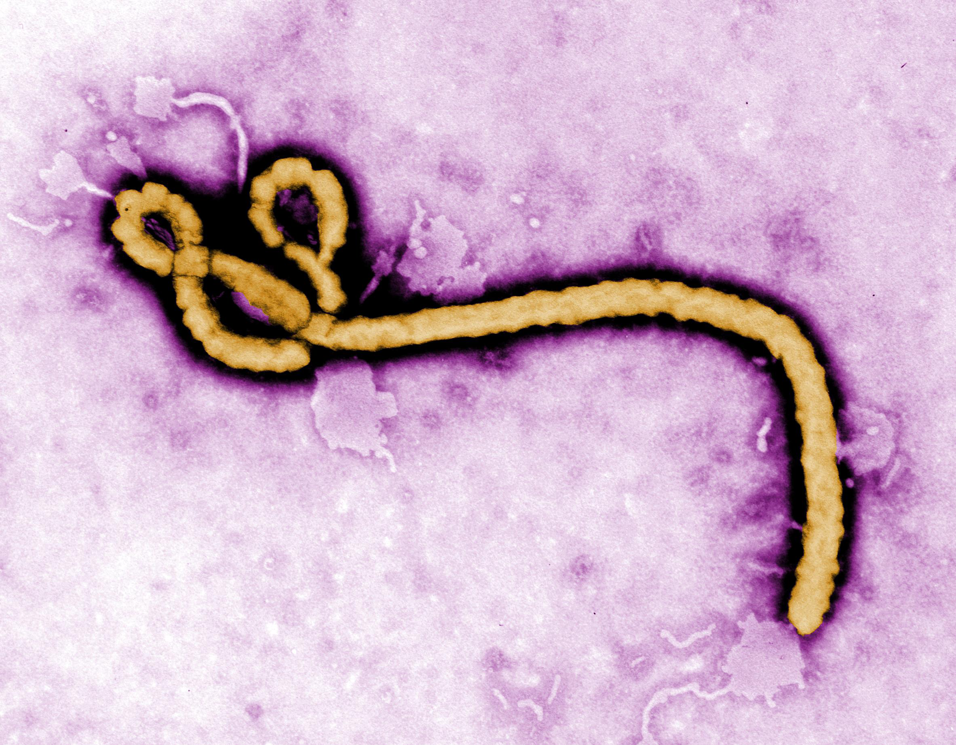 Zdjęcie przedstawia wirus ebola. Jest to podłużny wirus, który na jednym z końców tworzy pętelki. Na zdjęciu wybarwiony jest na żółto. Tło jest fioletowe.