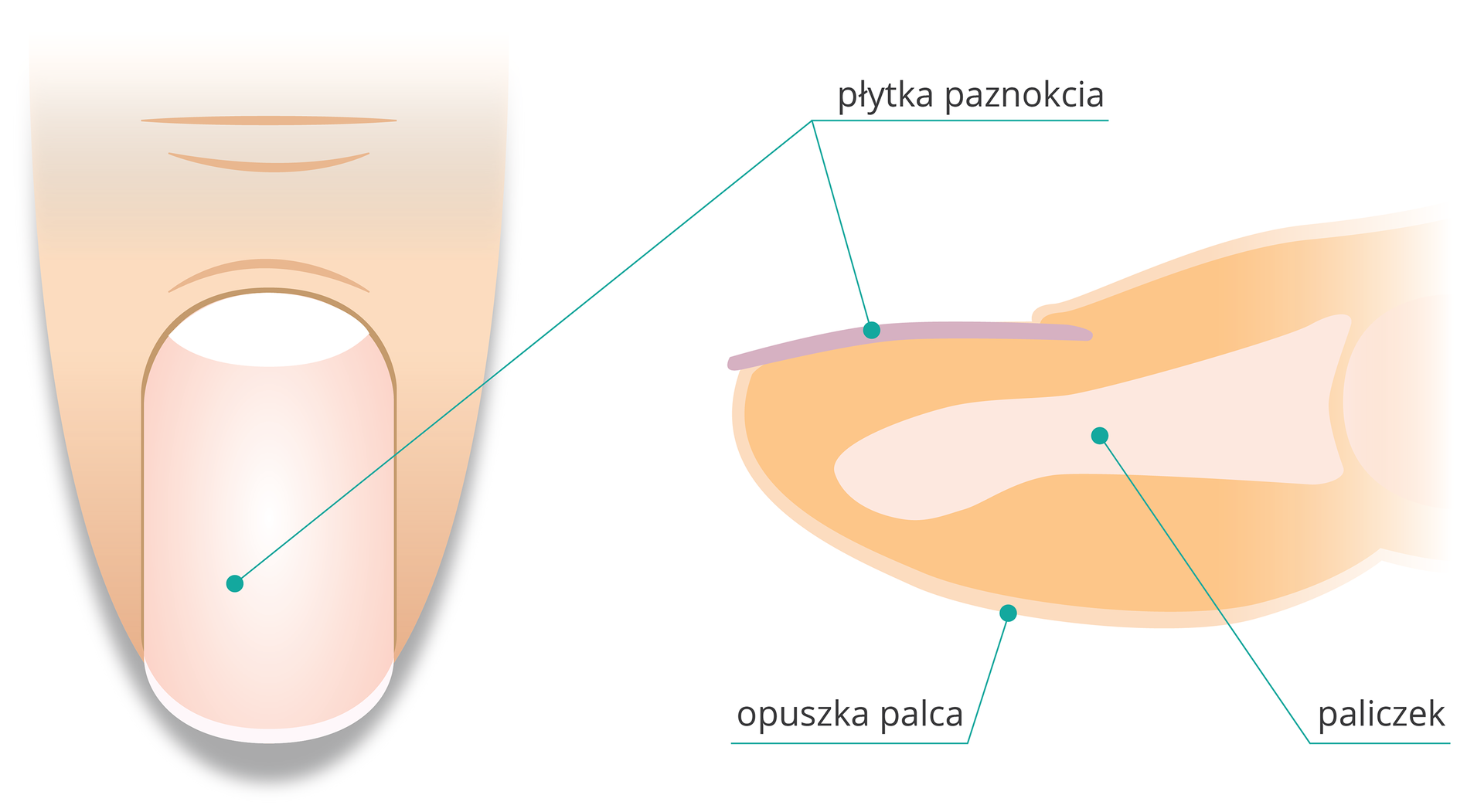 Ilustracja z lewej przedstawia w powiększeniu palec człowieka wraz z paznokciem widziany z góry. Z prawej przekrój poprzeczny przez czubek palca. W pomarańczowym wnętrzu opuszki palca zaznaczono białą kość paliczka. U góry na opuszce zaznaczono na fioletowo płytkę paznokcia.