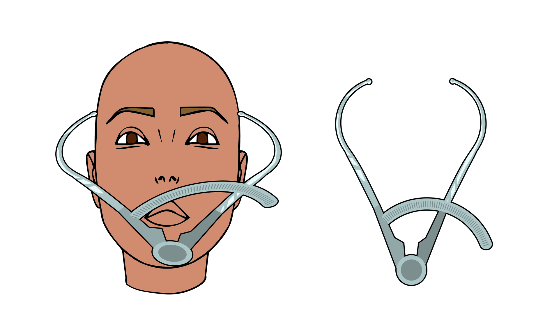 Grafika przedstawiająca cyrkiel kabłąkowy, czyli metalowy przyrząd przypominający zagiętą pęsetę z miarką przy miejscu połączenia ramion. Aby zmierzyć szerokość czaszki, cyrkiel przykłada się do czaszki w taki sposób, że oba ramiona dotykają przestrzeni ponad uszami na wysokości skroni. Wynik jest sczytywany z miarki. 
