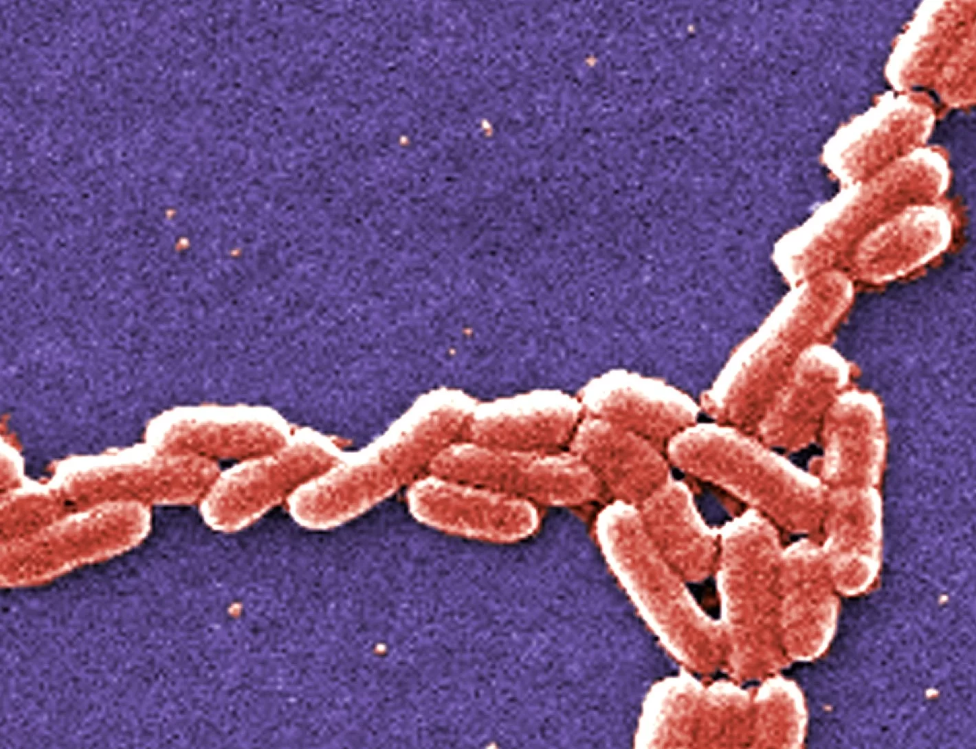 Mikroskopowe zdjęcie pałeczek okrężnicy Escherichia coli. Kształtem przypominają pałeczki.