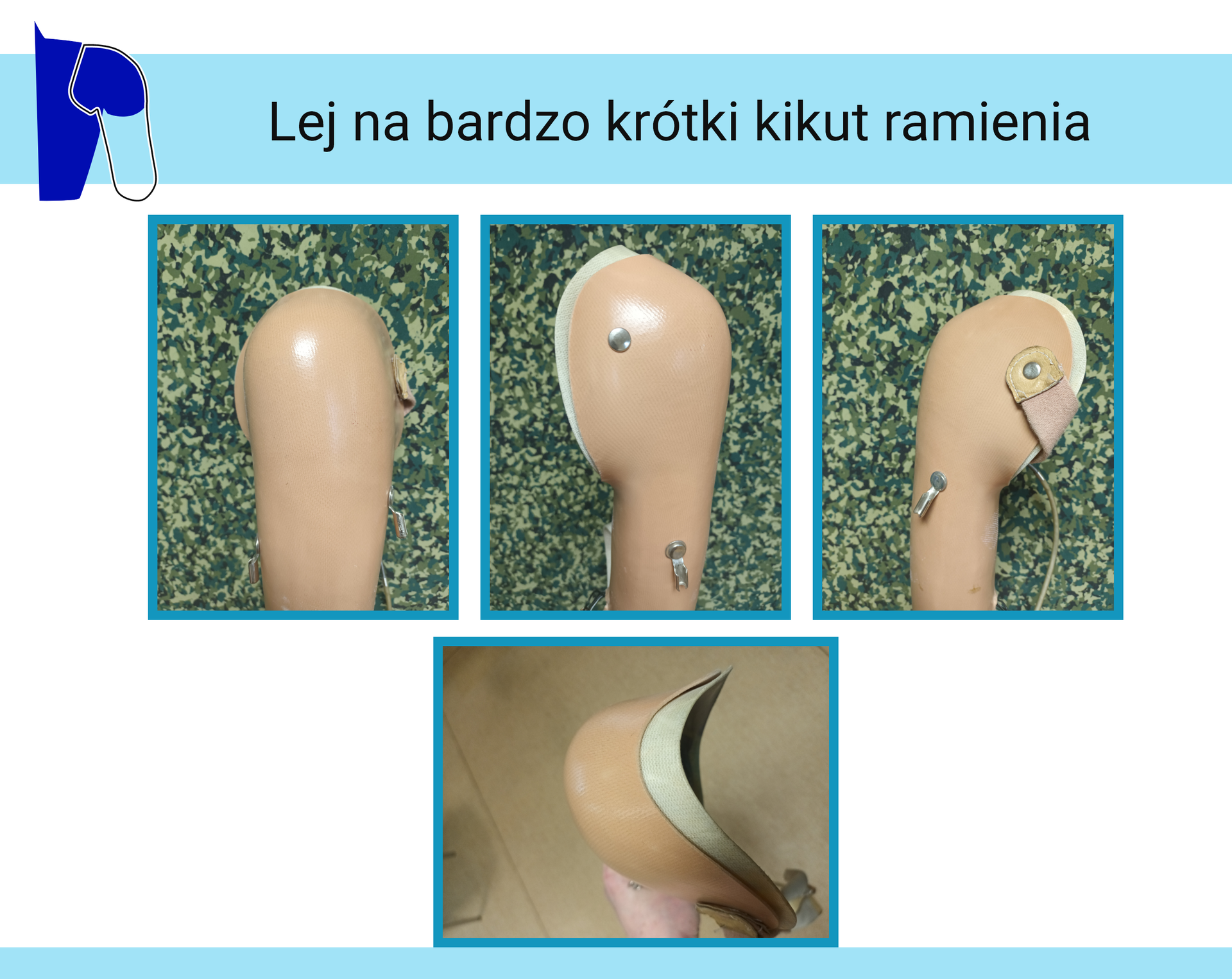 Zdjęcia leja na bardzo krótki kikut ramienia w widoku z góry, przodu i dwóch boków. Lej jest wykonany z tworzywa sztucznego, ma materiałową wyściółkę. Na leju znajdują się: skórzany pasek oraz wystające metalowe elementy. 