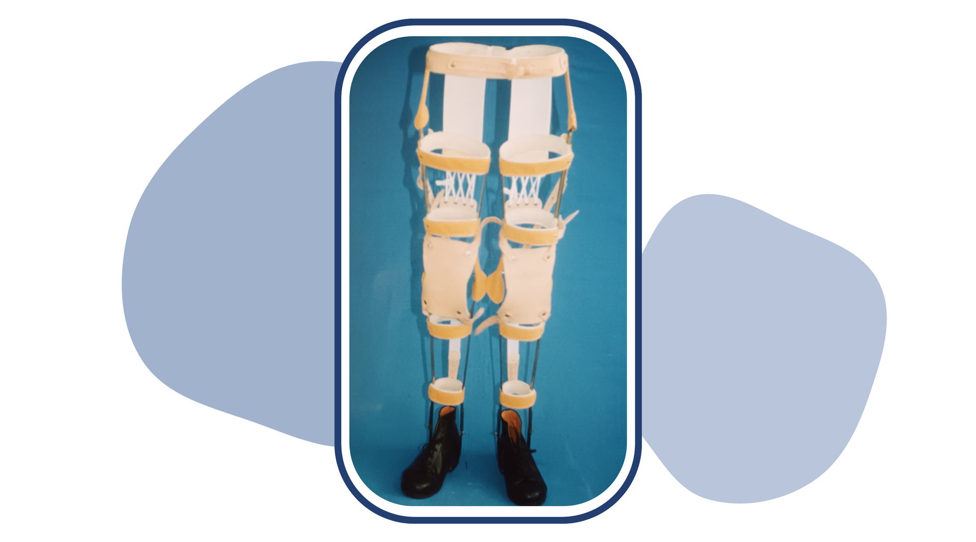 Zdjęcie przedstawia szkieletowe ortezy na obie kończyny dolne. Ortezy mają szyny biegnące wzdłuż całej nogi użytkownika. Połączone są z obuwiem. Ortezy są zaopatrzone w cztery opaski wypadające na wysokości kostki, pod stawem kolanowym, nad stawem kolanowym i w górnej części uda pacjenta. Aparaty ortopedyczne są zakończone pasem wypadającym na wysokości bioder i szyną wspomagającą stabilizację na całej długości tyłu kończyn. W miejscu, w którym wypada przód kolan użytkownika, znajdują się dodatkowe elementy stabilizujące zgięcie. 