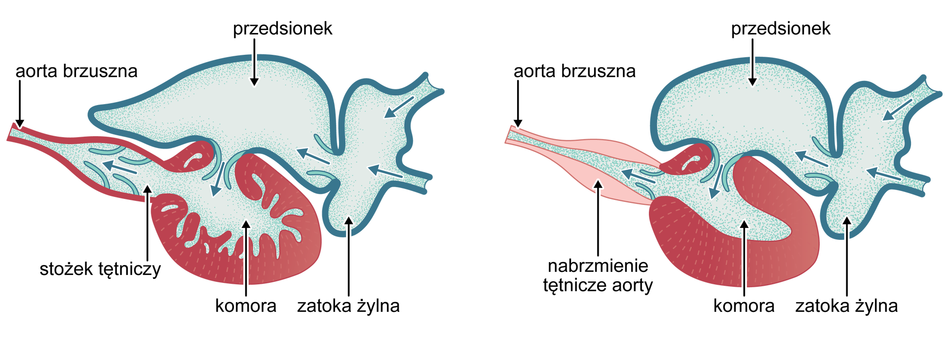 Schemat budowy serca ryb po lewej stronie przedstawia budowę serca ryby chrzęstnoszkieletowej, a po prawej stronie ryby kostnoszkieletowej. W górnej części schematu serca ryby chrzęstnoszkieletowej przedstawiona jest zatoka żylna a do niej dochodzą żyły. Krew od zatoki żylnej przychodzi do przedsionka, który jest przedstawiony w górnej części schematu. Od przedsionka krew przechodzi do komory przedsionka. Komora oraz przedsionek mają kształt kulisty. Od komory odchodzi stożek tętniczy w postaci pękatego przewodu z pionowymi elementami, które rozstępują się wpuszczając krew do środka. Następnie środek zwęża się zamieniając się aortą brzuszną. Schemat przedstawiający budowę ryby kostnoszkieletowej jest bardzo zbliżony do wyżej opisanego w swej górnej części. Żyły dochodzą do zatoki żylnej, a następnie krew wpływa do przedsionka. Jednak w dolnej części schemat ryby kostnoszkieletowej rożni się od chrzęstnoszkieletowej. Komora jest inaczej zbudowana – posiada jednolite i grubsze ściany. U ryby kostnoszkieletowej nie ma stożka tętniczego. Od komory od razu wychodzi aorta brzuszna, jej ściany są sporo grubsze i opisane są jako nabrzmienie tętnicze aorty.