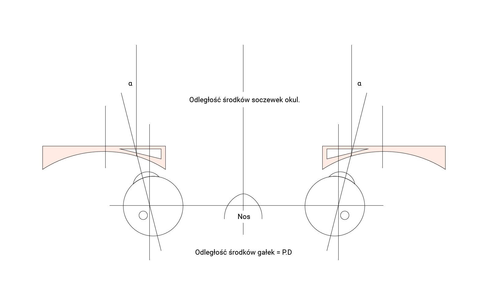 Grafika przedstawia wymuszenie zeza rozbieżnego przez okulary z soczewkami ujemnymi o za dużym rozstawieniu soczewek.