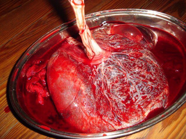 Zdjęcie przedstawia ludzkie łożysko. Jest ono umieszczone w okrągłej misie, w której znajduje się krew. Łożysko ma kolor czerwony, przecinają je liczne białe naczynia krwionośne. Od góry od łożyska odchodzi pępowina.