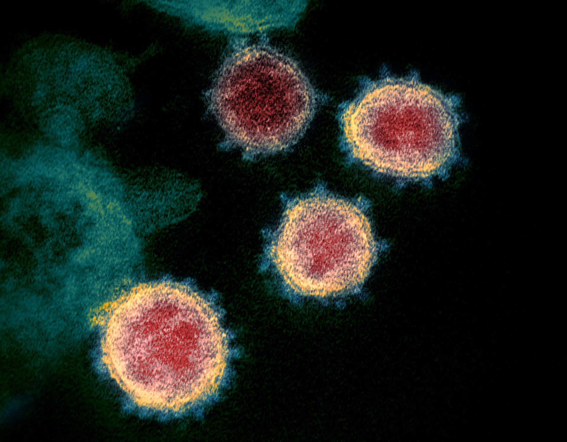 Na zdjęciu mikroskopowym widoczne okrągłe koronawirusy. Wewnątrz czerwone, na zewnątrz z żółtą obwódką i niebieskimi kolcami. Tło zdjęcia jest czarne.