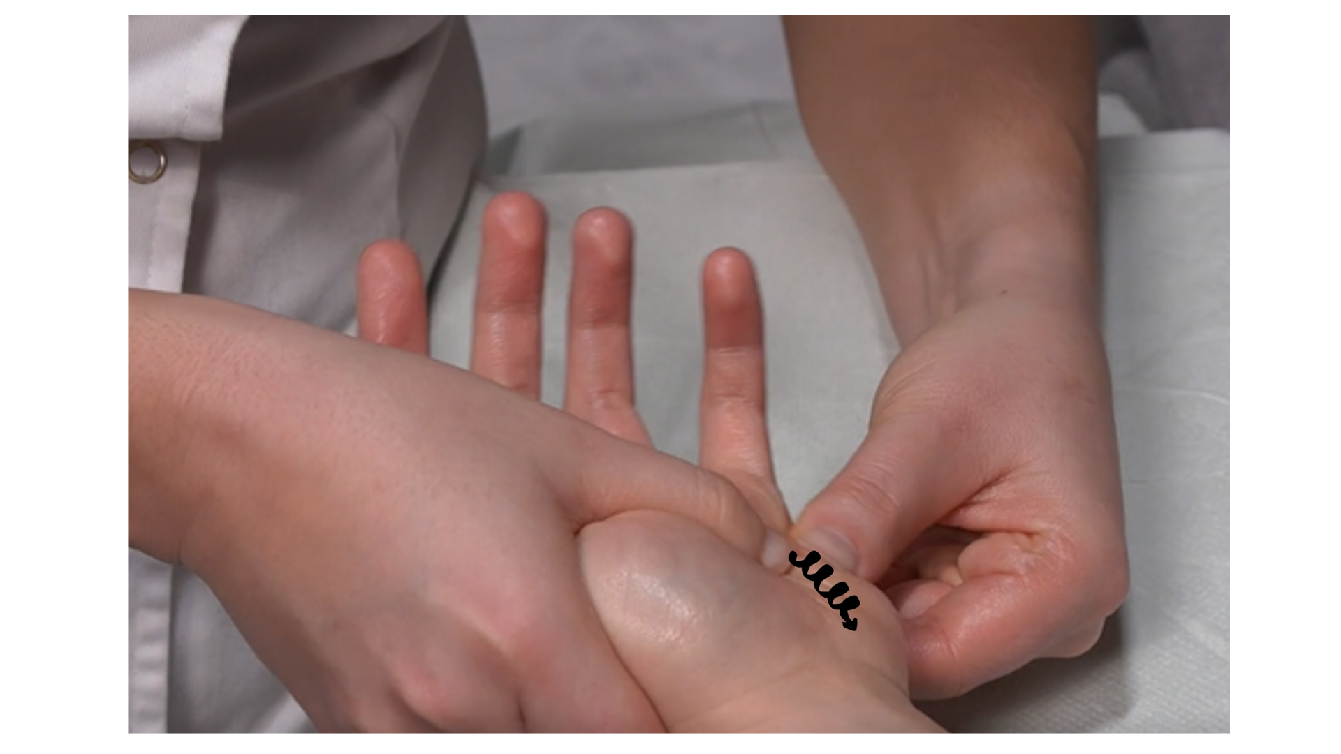 Zdjęcie przedstawia lewą rękę pacjenta leżącą na stole do masażu. Masażysta wykonuje ruch okrężny opuszkami kciuków po wewnętrznej stronie ręki pacjenta od palców w stronę nadgarstka. Drugą ręką przytrzymuje grzbiet ręki pacjenta. 