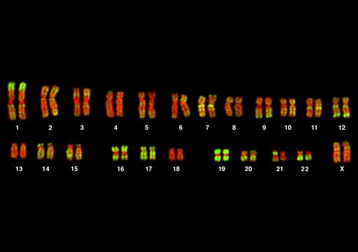 Budowa i rodzaje chromosomów eukariotycznych