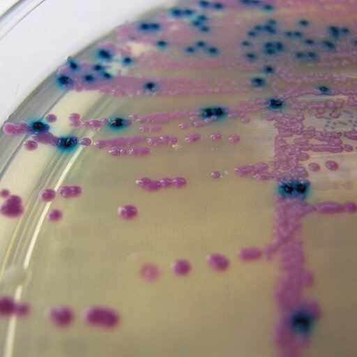 Bakterie Gram‑dodatnie i Gram‑ujemne