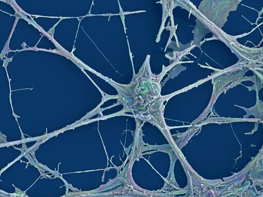Rodzaje i budowa synaps