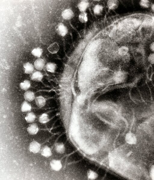 Wirusy − historia odkrycia i właściwości